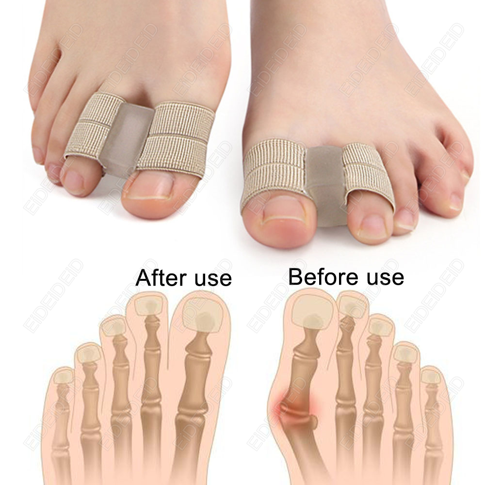 Bunion toe Corrector Orthotics - đánh giá và giá Women'S Shoes For Bunions